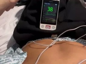 在新的医院录像中，马克斯·乔治紧紧抓住心脏监护仪，因为它似乎关闭了